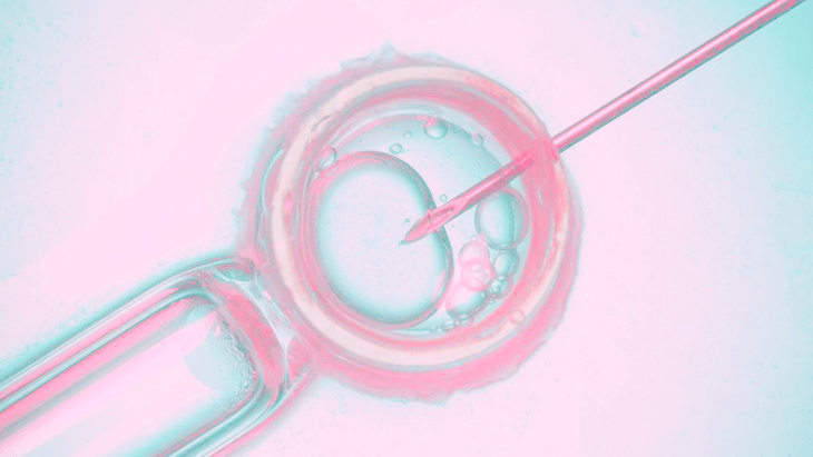 IVF