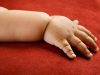 Scans reveal babies of mothers with gestational diabetes have more body fat