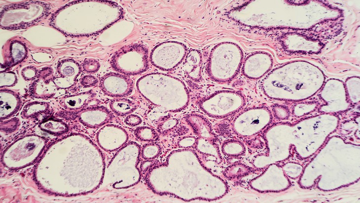 The Hippocratic Post - biopsy