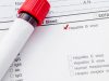 Viral hepatitis kills as many as malaria, TB or HIV/AIDS