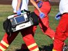 Defibrillators in communities save lives