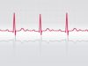 Self-monitoring to reduce risk of AF-related stroke