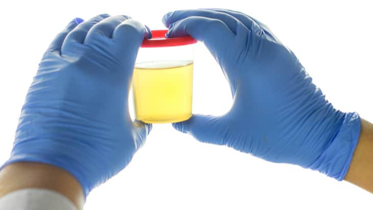 urine