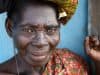 Ghana eliminates trachoma