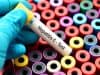 World Hepatitis Day: the missing millions