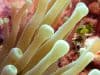 Blood tests could predict bowel cancer return