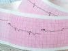 Take your places for the Heart Rhythm Congress