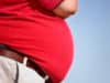 Weight loss surgery best for obese adults