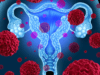 Researchers Develop Early Detection Test for Ovarian Cancer