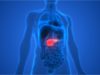Charity Calls for Specific Policy Target for Lowest Survival Rate Cancers