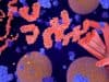 Protein tangles linked with Dementia
