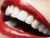Oral health in lockdown