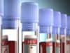 National HIV Testing Week is Here!