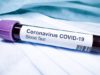 Home testing to track infection levels in community