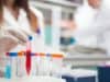 Clinical trial to treat hospitalised patients with covid-19