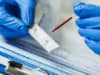 Covid-19: Expert comment on antibody tests