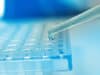 Covid-19 impact on blood cancer patients receiving stem cell transplants