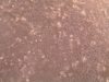 Innovative multiple-organ devices for brain diseases