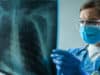 Referrals of urgent care lung conditions drop by up to 70%