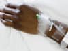 More patients from deprived regions in ICU
