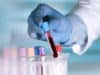 Patients value NHS diagnostic services but face barriers to access
