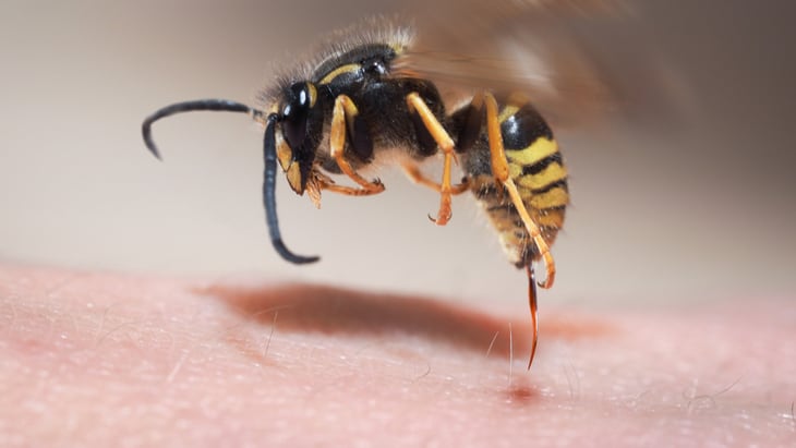 bites