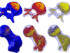 Using fat to diagnose musculoskeletal disease