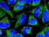 The antibacterial superhero inside our cells