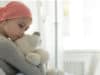 Most children with cancer have mild COVID-19