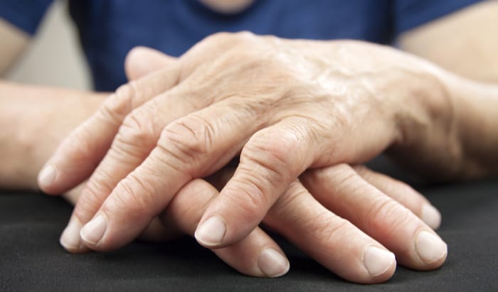 rheumatoid