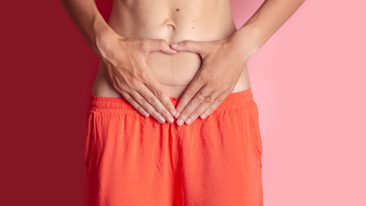 c-section