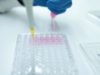 Skin cancer treatment to help transplant patients