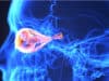 Glaucoma: gene therapy regenerates optic nerve