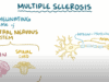 Multiple sclerosis – causes, symptoms, diagnosis, treatment, pathology