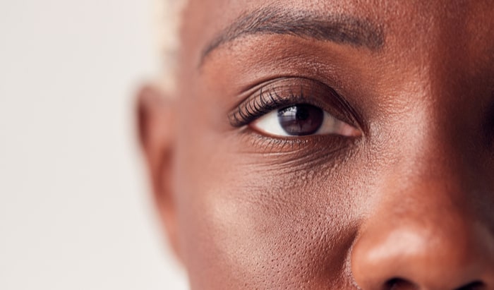 vision loss