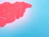 Obesity fuelling fatty liver disease