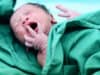 Global shortage of 900,000 midwives