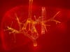 Liver transplants: Improving waitlist mortality