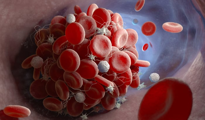 thrombotic risk
