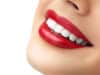Secrets to nailing the basics of good oral hygiene