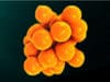 How to predict severe influenza in hospitalised patients