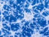 Non-invasive brain cancer treatment targeting glioblastoma
