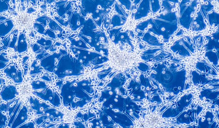 non-invasive brain tumour treatment