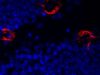 Non-invasive potential treatment for Alzheimer’s disease