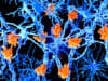 Working to stop MS in its tracks
