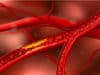 Cytokine APRIL protects from atherosclerotic cardiovascular disease