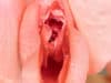 Gynaecological Cancer Awareness Month