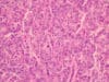 $8M from Snow Medical Research Foundation for Breast Cancer