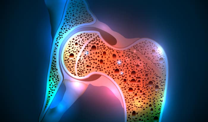 Bone mineral
