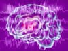 Identifying children at risk of developing epilepsy